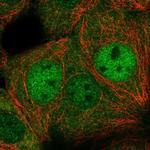 DIP2C Polyclonal Antibody