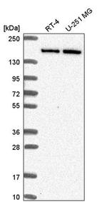 DIP2C Antibody in Western Blot (WB)