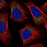 MRPL57 Polyclonal Antibody