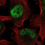 ZBTB38 Polyclonal Antibody