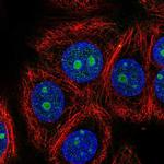 ZNF771 Polyclonal Antibody