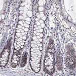 HNRNPA0 Antibody in Immunohistochemistry (Paraffin) (IHC (P))