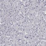 HNRNPA0 Antibody in Immunohistochemistry (Paraffin) (IHC (P))