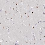 HNRNPA0 Antibody in Immunohistochemistry (IHC)