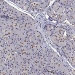 HNRNPA0 Antibody in Immunohistochemistry (IHC)