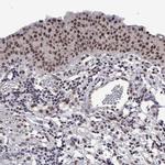 HNRNPA0 Antibody in Immunohistochemistry (IHC)