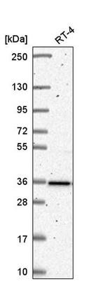 HNRNPA0 Antibody in Western Blot (WB)