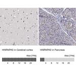 HNRNPA0 Antibody