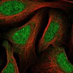 MNT Polyclonal Antibody