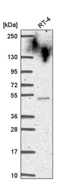 CYHR1 Antibody in Western Blot (WB)