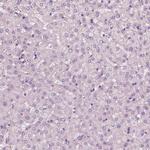 RS1 Antibody in Immunohistochemistry (Paraffin) (IHC (P))