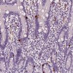 RS1 Antibody in Immunohistochemistry (IHC)