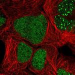 ZNF32 Polyclonal Antibody