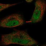TMEM107 Antibody in Immunocytochemistry (ICC/IF)