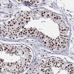ZNF420 Antibody in Immunohistochemistry (IHC)