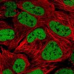 ZNF420 Antibody in Immunocytochemistry (ICC/IF)