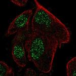 RPP25L Antibody in Immunocytochemistry (ICC/IF)
