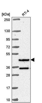 RFX8 Antibody in Western Blot (WB)