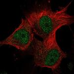 METT10D Polyclonal Antibody