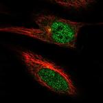 PGBD4 Polyclonal Antibody