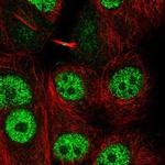 LYRM1 Polyclonal Antibody