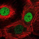 FAM58A Antibody in Immunocytochemistry (ICC/IF)