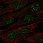 MAB21L1 Polyclonal Antibody