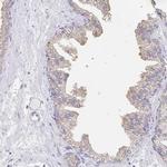 PDE6B Antibody in Immunohistochemistry (IHC)