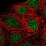 SMARCD2 Polyclonal Antibody