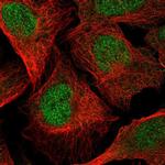 C5orf28 Polyclonal Antibody