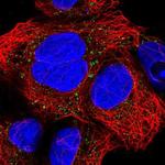 CNNM2 Antibody in Immunocytochemistry (ICC/IF)