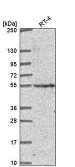 CNNM2 Antibody in Western Blot (WB)