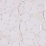 GRHL3 Antibody in Immunohistochemistry (Paraffin) (IHC (P))