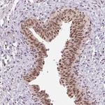 GRHL3 Antibody in Immunohistochemistry (Paraffin) (IHC (P))