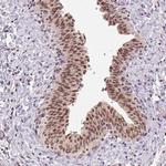GRHL3 Antibody in Immunohistochemistry (IHC)