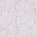 GRHL3 Antibody in Immunohistochemistry (IHC)