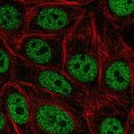 GRHL3 Antibody in Immunocytochemistry (ICC/IF)