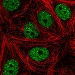 MAMDC4 Polyclonal Antibody