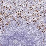 MAMDC4 Antibody in Immunohistochemistry (IHC)