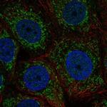 ZNHIT3 Polyclonal Antibody