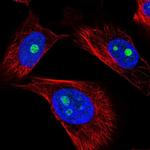 GNL2 Polyclonal Antibody