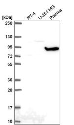 GNL2 Antibody in Western Blot (WB)