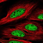 CCDC174 Polyclonal Antibody