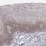 MRPL3 Polyclonal Antibody