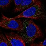 ESPN Polyclonal Antibody