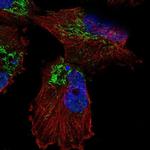 SLC25A14 Polyclonal Antibody