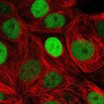 TRPS1 Polyclonal Antibody