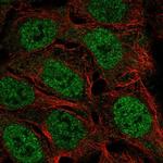 FAM49A Polyclonal Antibody