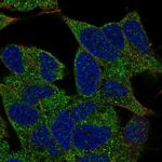 TMEM145 Polyclonal Antibody