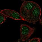 CYB5RL Polyclonal Antibody